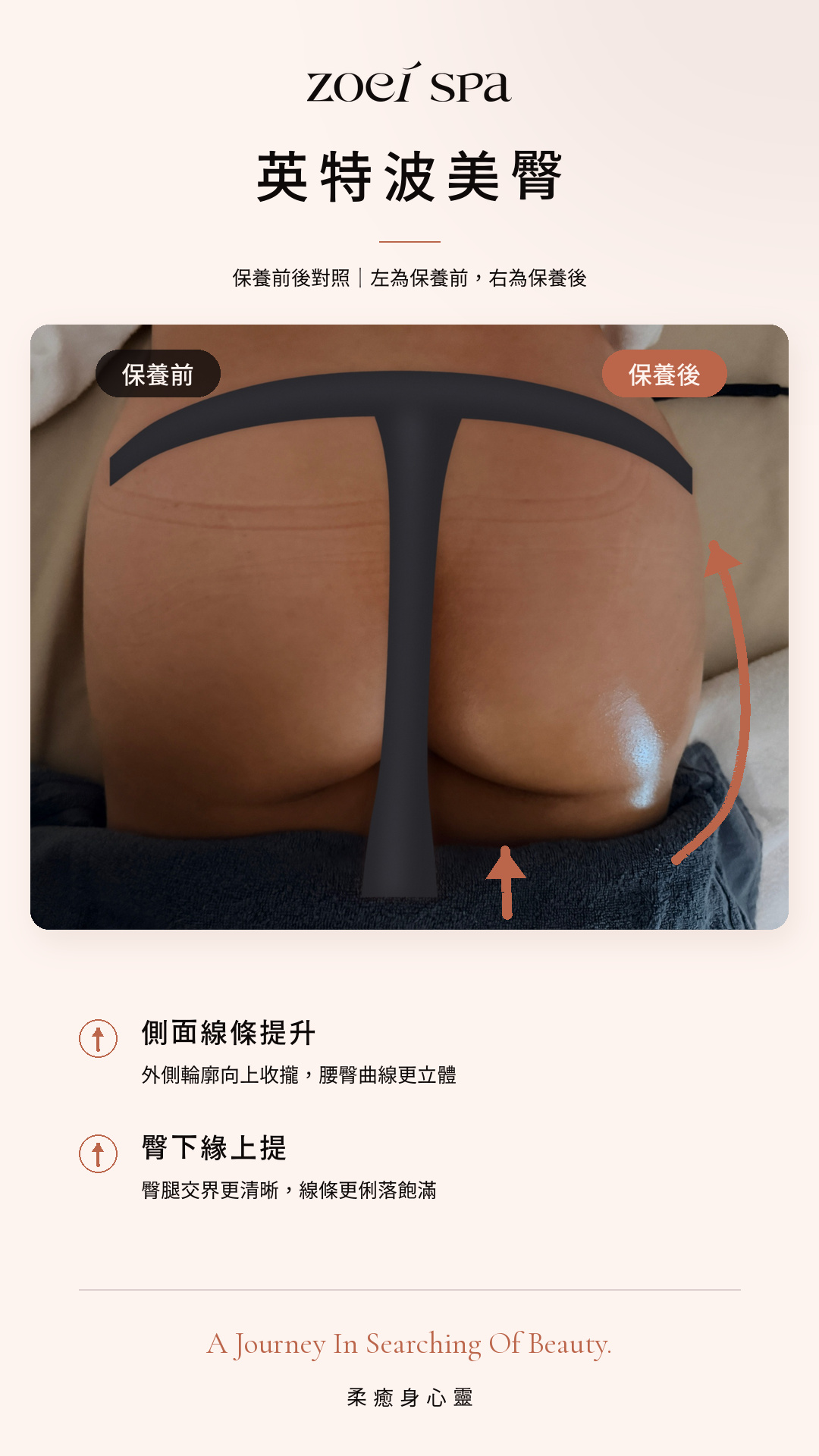 INDIBA 英特波 美容護理案例照片 4
