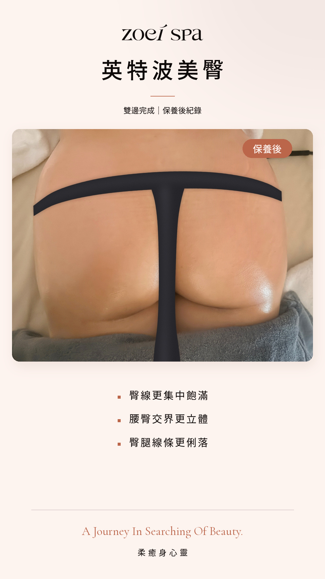 INDIBA 英特波 美容護理案例照片 5